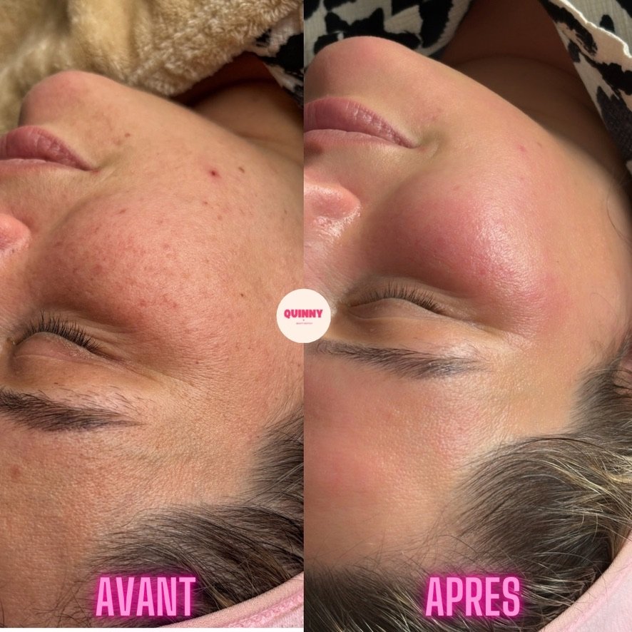 Aperçu promo beauté